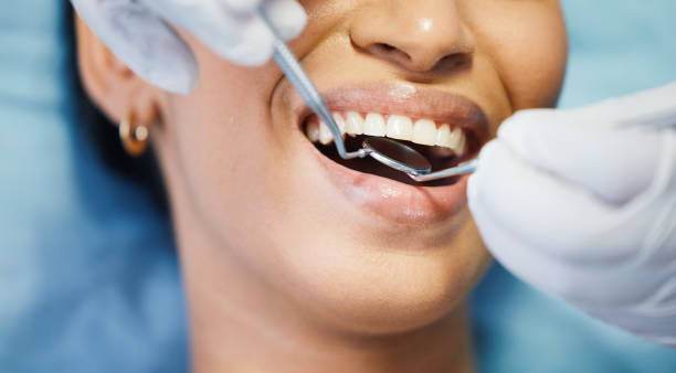 Best Broken or Cracked Tooth Emergency Dentist in Fulton, NY