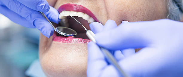 Best Emergency Dentist for Knocked-Out Tooth in Fulton, NY